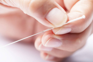 Acupuncture Bromley