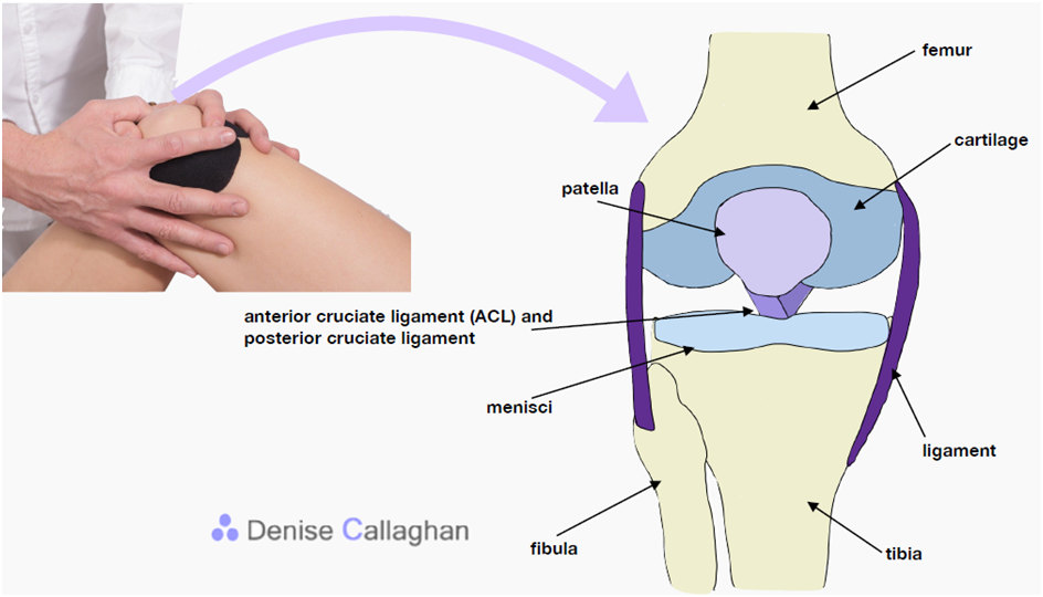 Knee Pain - Denise Callaghan