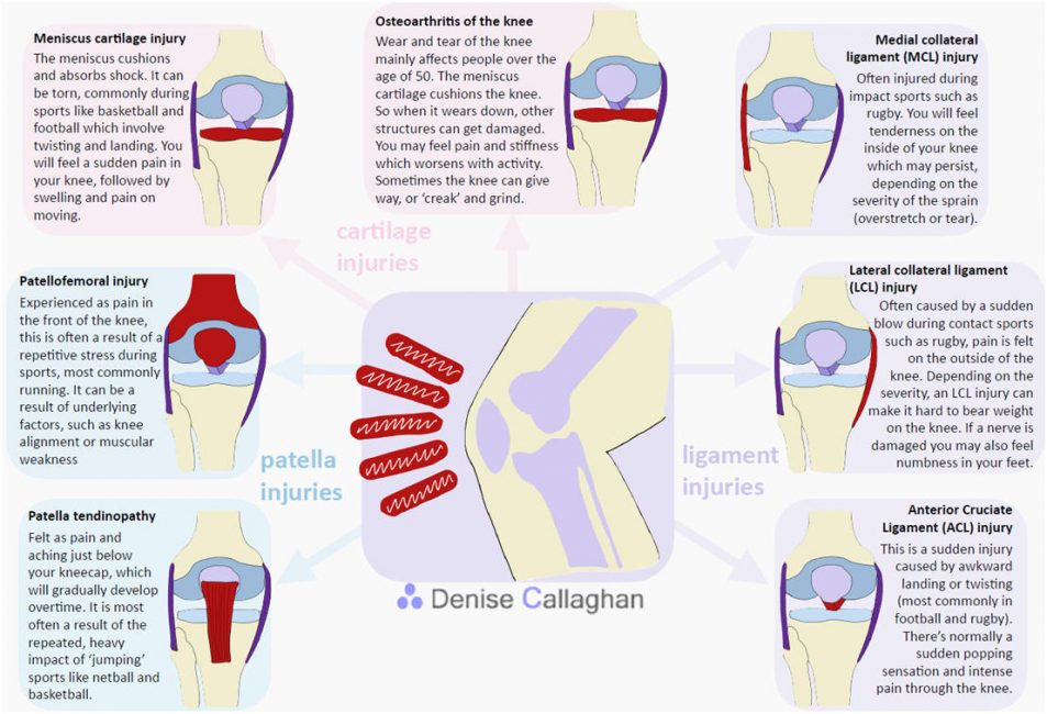 pain above knee cap